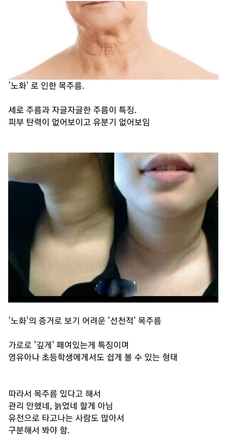 nokbeon.net-목주름을 노화의 흔적만이 아닌 이유-1번 이미지
