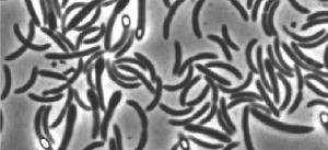 방사성 요오드를 안정된 광물로 만드는 박테리아인 디설포스포로시누스 아우리피그먼티.