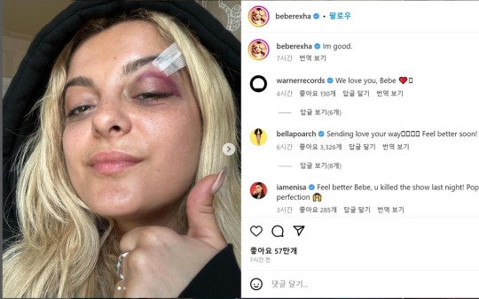 [정보/소식] 美가수 비비 렉사, 공연중 관객이 던진 핸드폰에 맞아 얼굴 부상 | 인스티즈