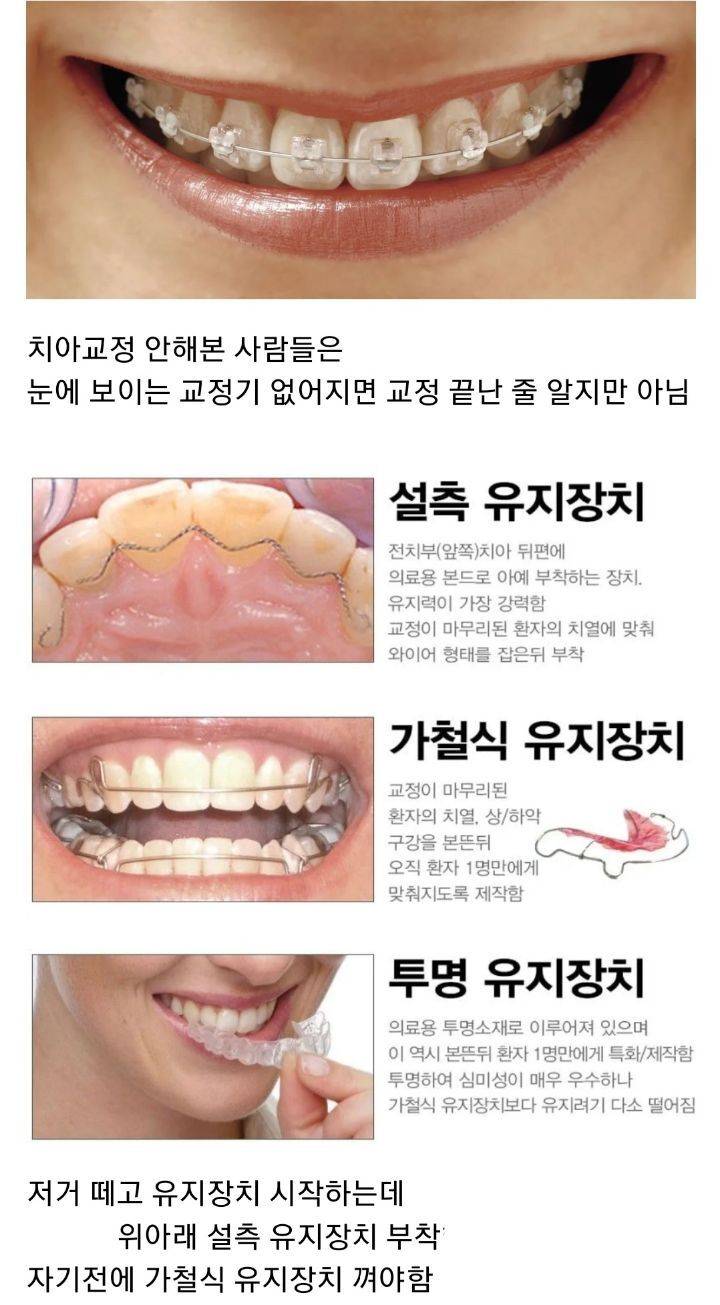 치아교정이 힘든이유 | 인스티즈