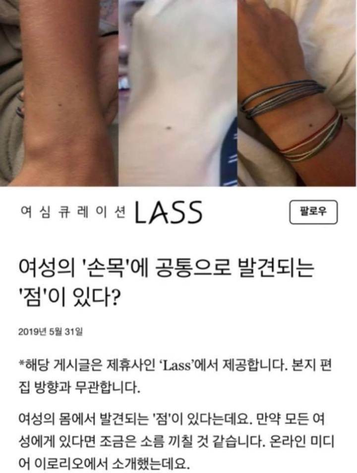 여성의 손목에 공통으로 발견되는 점이 있대🤔 | 인스티즈