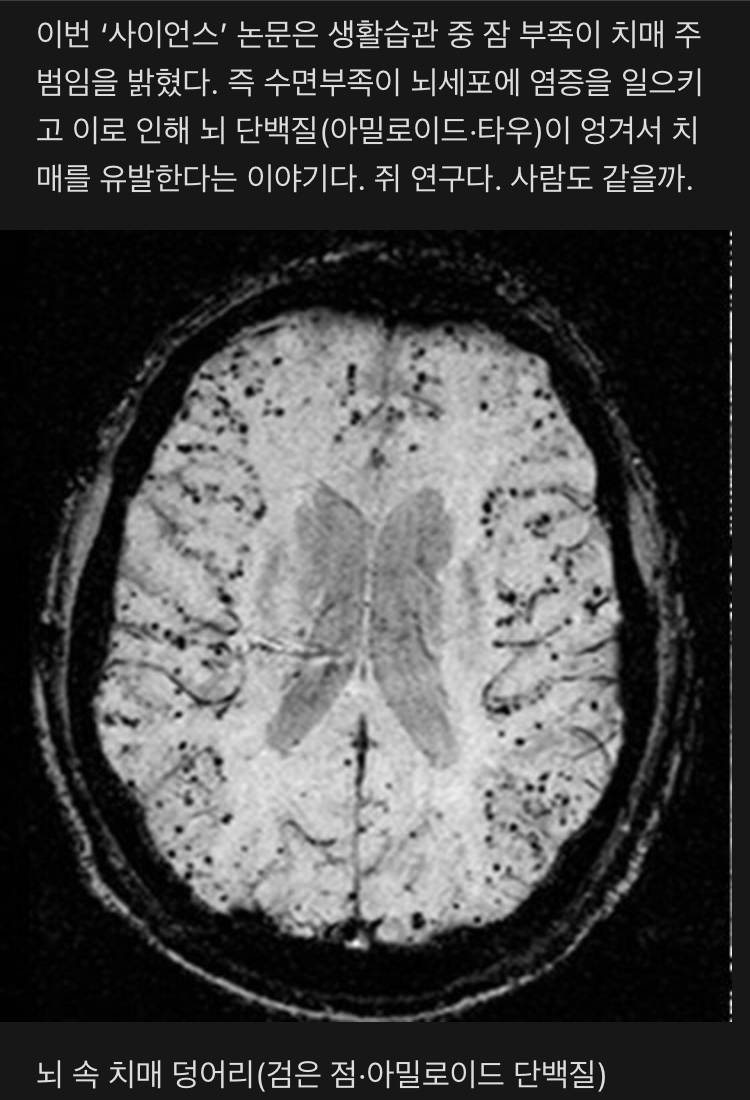 수면이 부족하면 언젠가 그 댓가를 치른다 | 인스티즈