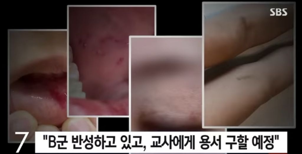 얼마전 초등교사 폭행했던 아이 부모."용서구하고 사죄하겠다" | 인스티즈