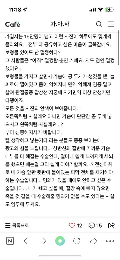 나 드디어 천만원 모아서 모티바로 가슴수술 하려고! | 인스티즈