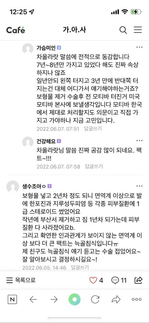 나 드디어 천만원 모아서 모티바로 가슴수술 하려고! | 인스티즈