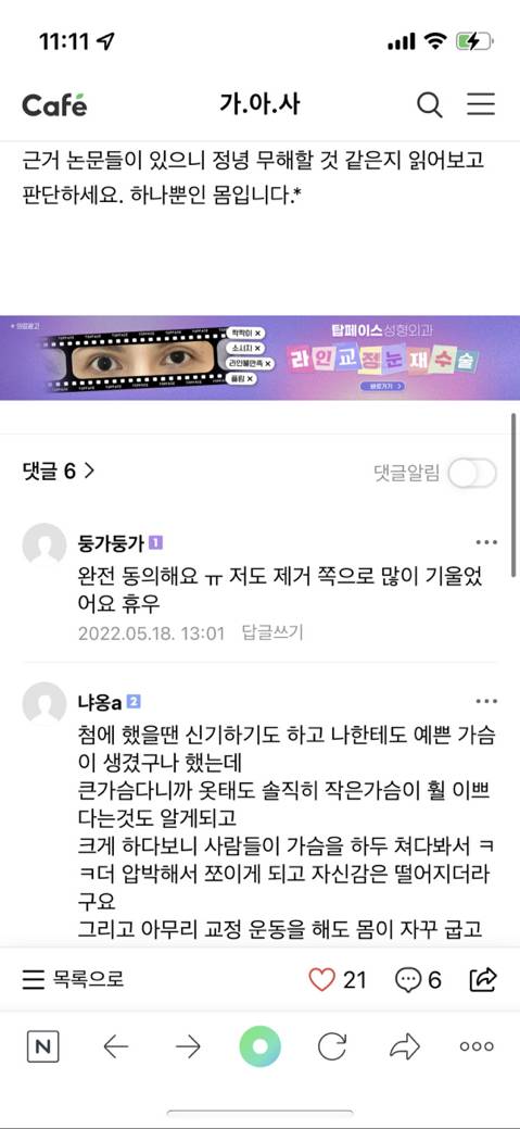 나 드디어 천만원 모아서 모티바로 가슴수술 하려고! | 인스티즈