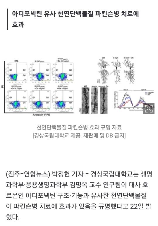 경상국립대 김명옥 교수, 파킨슨병 치료제 새 길 열었다 | 인스티즈