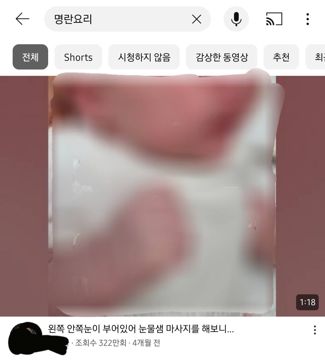 개극혐영상들 이유없이 자꾸 떠서 불편하다고 말 나오는 중인 유튜브.jpg | 인스티즈