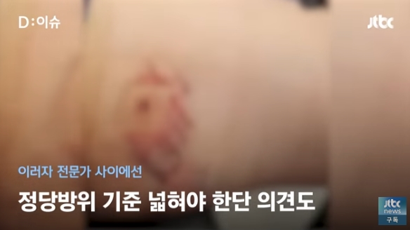 칼부림당할때 대응하면 피의자 되는 현실 | 인스티즈