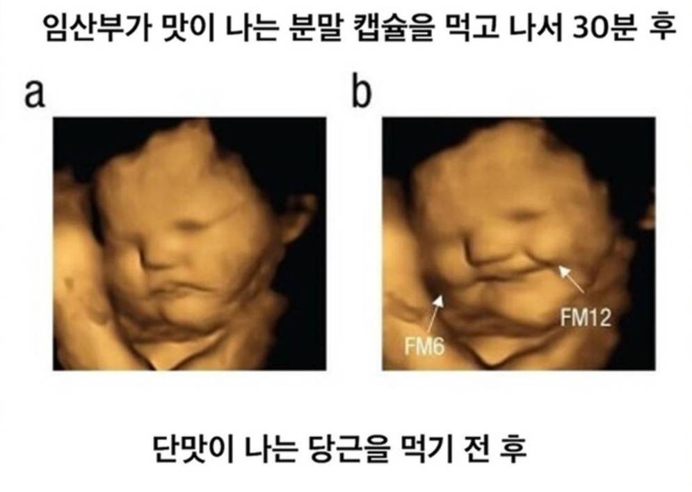 임신했을 때 아기가 먹고싶다는 말이 맞나봄 | 인스티즈