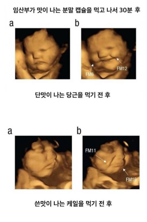 임신중 아기가 먹고싶다는 게 맞다는 증거.jpg | 인스티즈