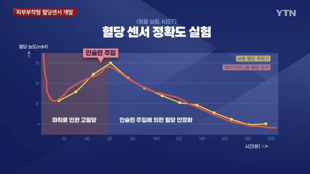 당뇨 환자에 희소식...피부 부착형 혈당 센서 개발 | 인스티즈