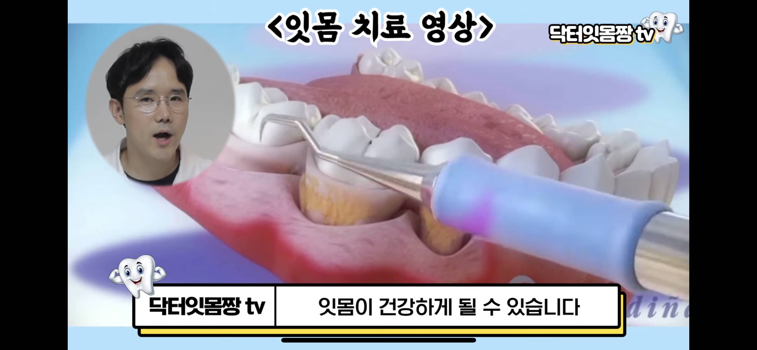 치과에서 잇몸치료 해야하는 이유 | 인스티즈