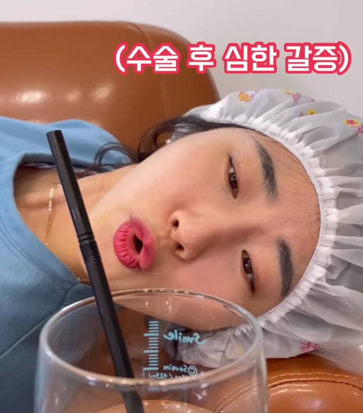 출산의 현실(무통주사, 자연분만, 제왕절개) | 인스티즈