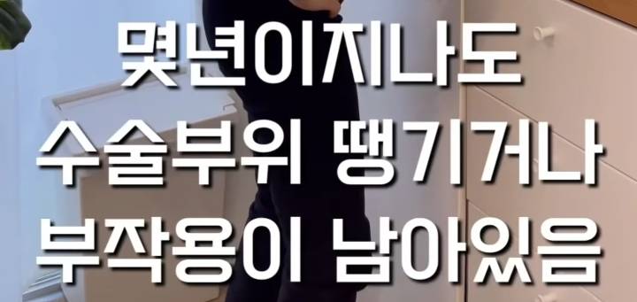 출산의 현실(무통주사, 자연분만, 제왕절개) | 인스티즈