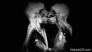 MRI로 보는 키스와 성관계 | 인스티즈