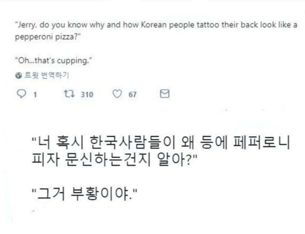 외국인이 보는 부항자국 | 인스티즈