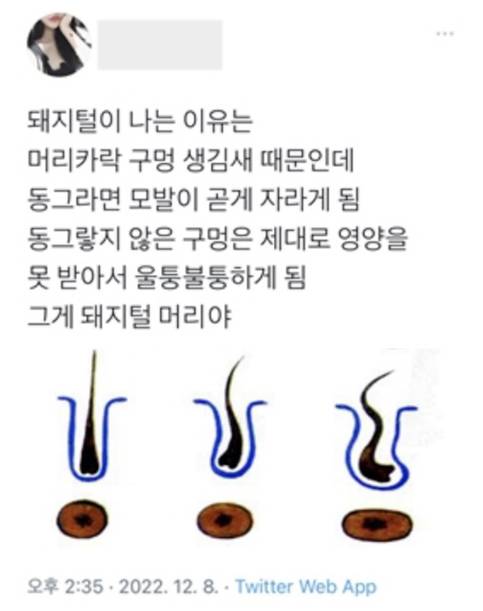 정수리에 돼지털(머리)나는이유 | 인스티즈