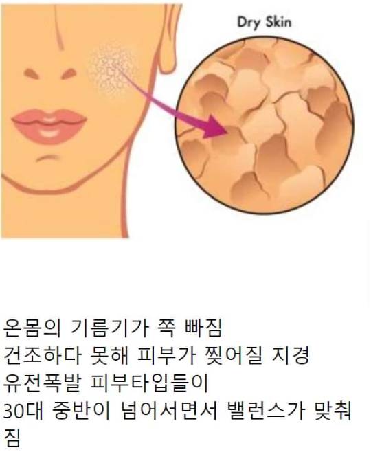 30대 갑자기 밀려온 노화에 현타온 여자 | 인스티즈