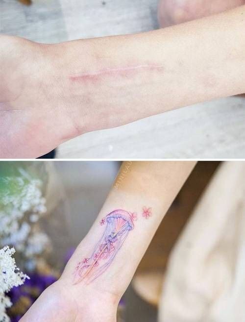 흉터 가려주는문신 | 인스티즈