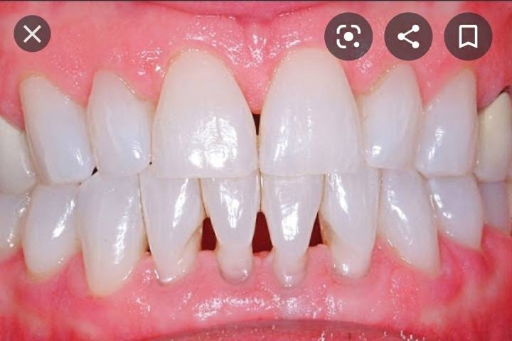 갑자기 치아관리를 개빡세게 하고싶어지는 댓글 | 인스티즈