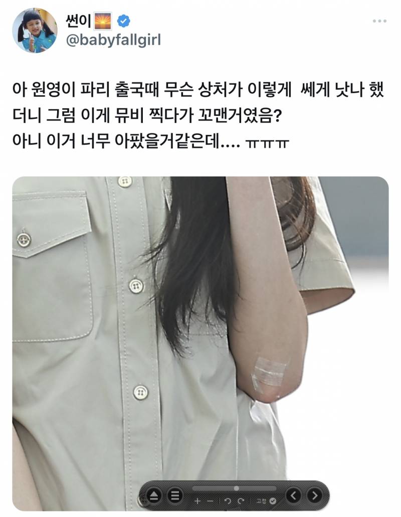 아이브 I AM 뮤비 찍다가 응급실가서 7바늘 꿰맸던 장원영.jpg | 인스티즈