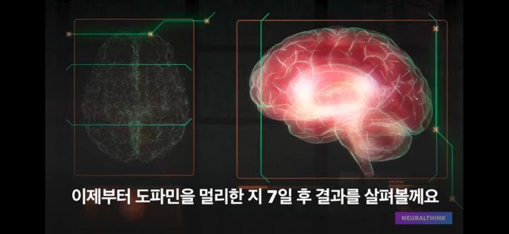 도파민 디톡스 7일이면 뇌가 변함! | 인스티즈