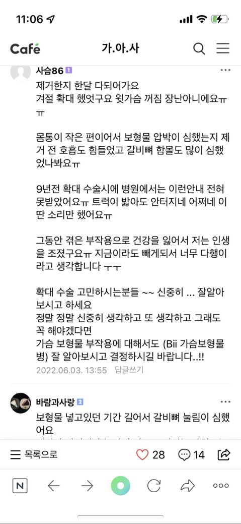 나 드디어 천만원 모아서 모티바로 가슴수술 하려고! | 인스티즈