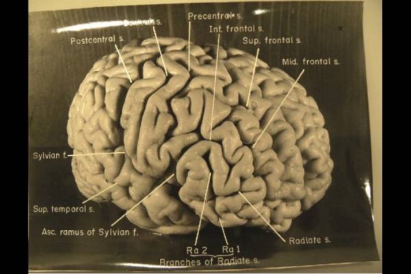 미국 박물관에 전시된 아인슈타인의 뇌.jpg | 인스티즈