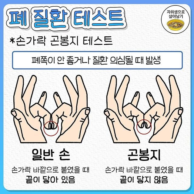 1분 안에 하는 각종 질병 의심 초간단 테스트.jpg | 인스티즈