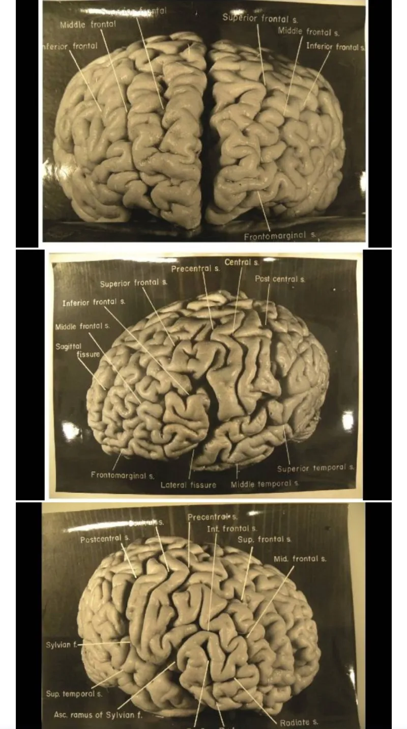 미국 박물관에 전시된 아인슈타인의 뇌 | 인스티즈
