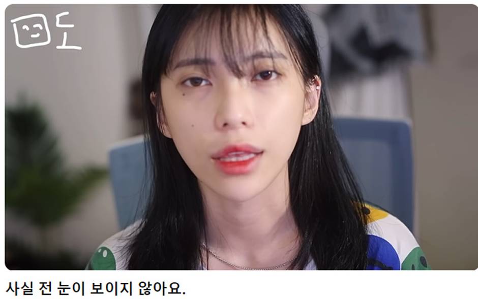 가수 데뷔한다는 소식 알린 희귀병 걸려 화제 되었던 여자 유튜버…jpg | 인스티즈