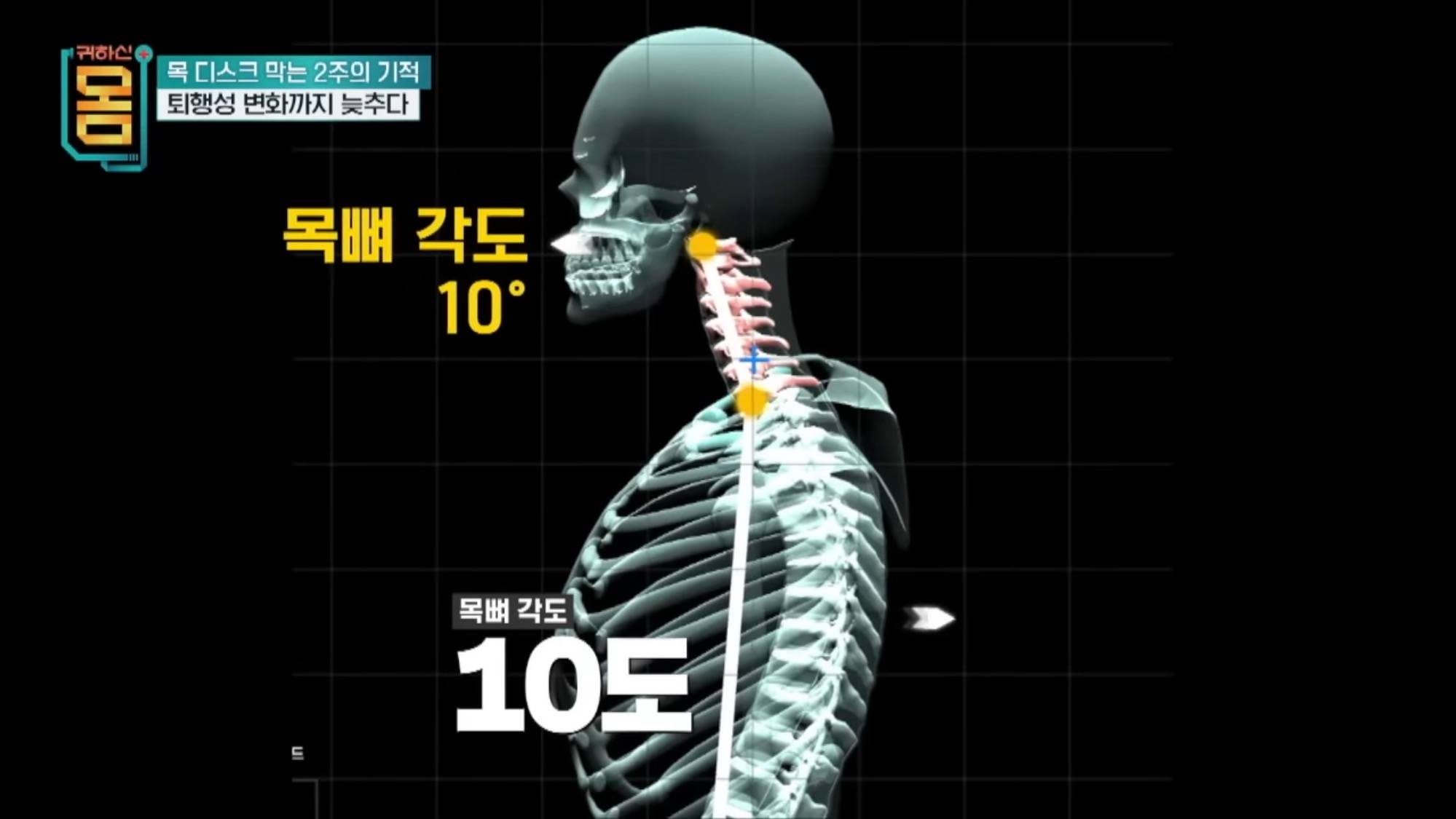 2주만에 효과 대박인 거북목•일자목 마사지&운동 | 인스티즈