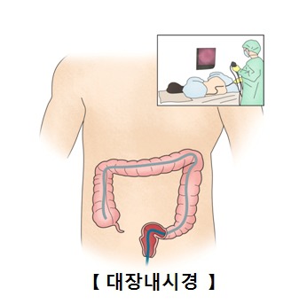 팔만대장경 전부 외우기 vs 대장내시경 8만번 하기 | 인스티즈