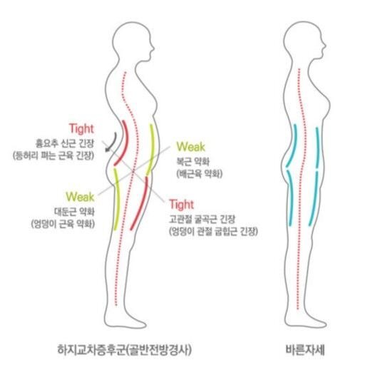 코어근육이 무너진 사람 특징.jpg | 인스티즈