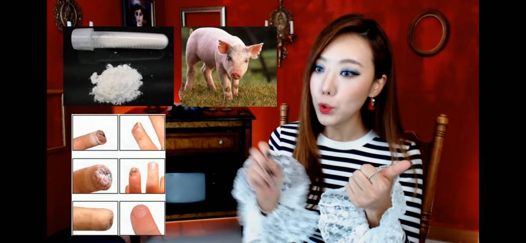 돼지 방광으로 잘린손가락 재생사례(손가락사진 주의) | 인스티즈