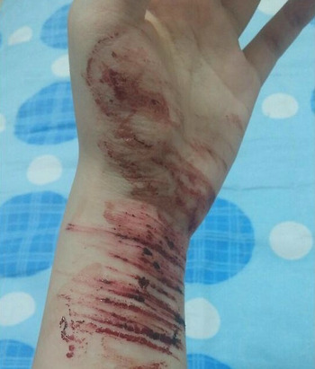 제발 성인이 어린 청소년과 성관계 하는걸 막아 주세요 상처/피사진있어요(주의!) | 인스티즈