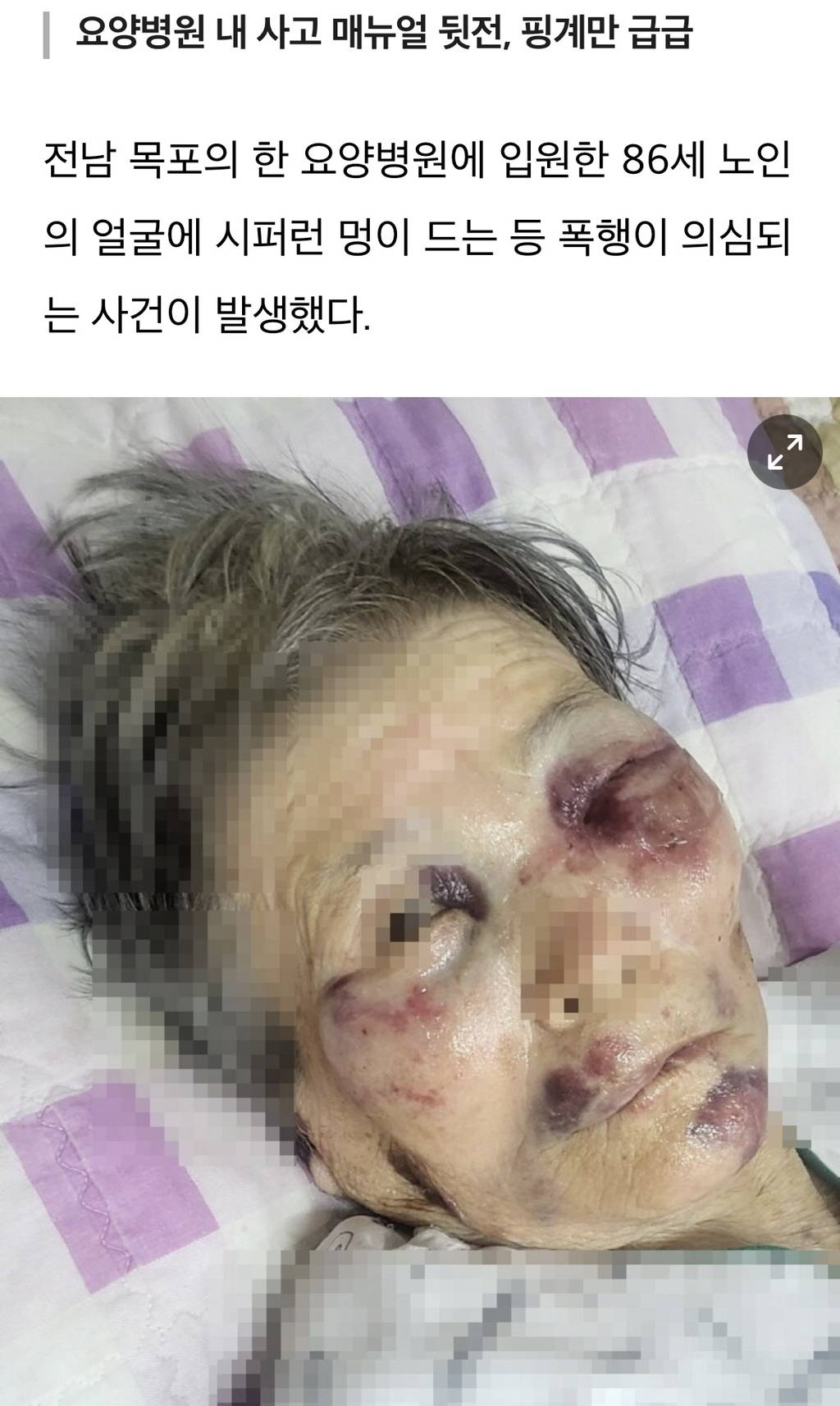 목포 A요양병원 노인 폭행의혹…병원은 쉬!쉬! | 인스티즈