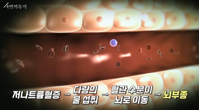 법의학자가 생각하는 이소룡의 사망 원인 | 인스티즈