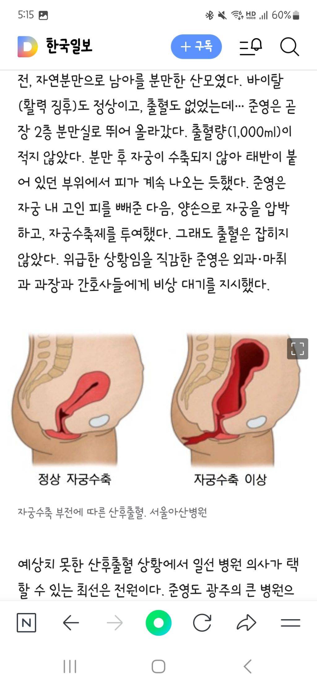 대학병원 옮기는 데 10시간··· 서른셋 산모, 둘째 낳고 하늘나라로 (스압) | 인스티즈