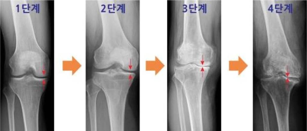 맨날 북마크만 하고 까먹지 않았으면 하는 관절 다 고장나는 최악의 자세들.jpg | 인스티즈