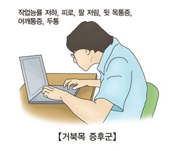 맨날 북마크만 하고 까먹지 않았으면 하는 관절 다 고장나는 최악의 자세들.jpg | 인스티즈