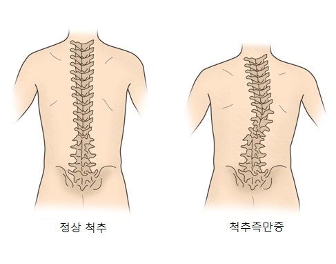 nokbeon.net-발병 원인이 잘못 알려진 질병...jpg-1번 이미지