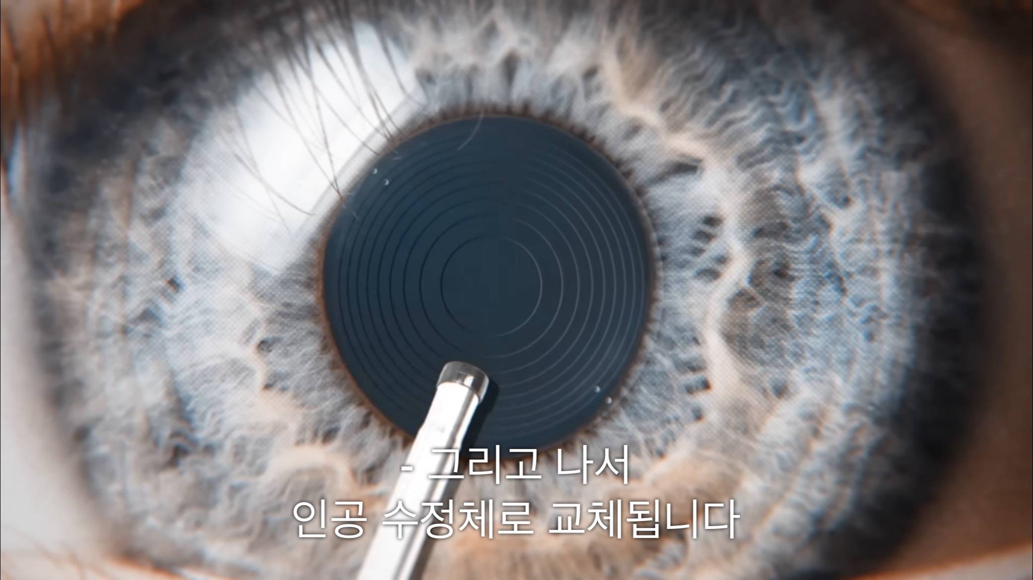 시각장애인 천명 수술시켜 준 미스터 비스트.jpg | 인스티즈
