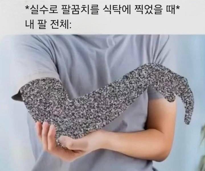 실수로 팔꿈치 찍혔을 때...jpg