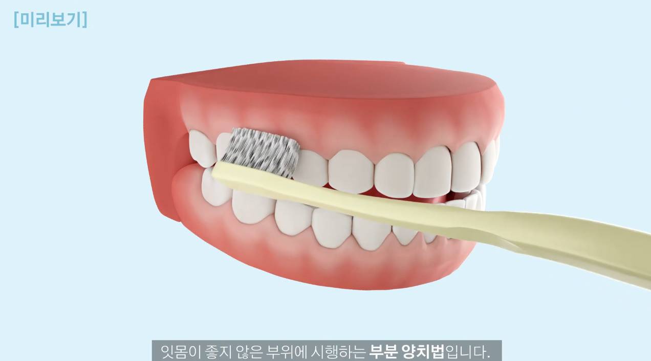 치과의사들이 추천한다는 양치질 방법 | 인스티즈