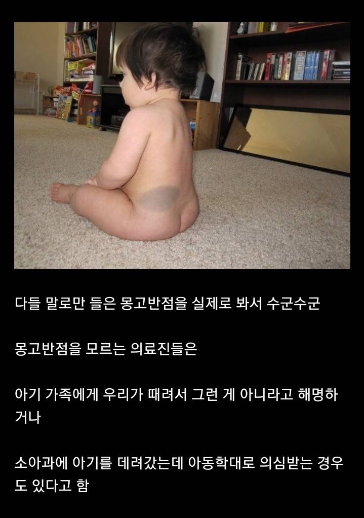 과거 미국 산부인과에서 동양인 아기 태어나면 놀라는 이유.jpg | 인스티즈