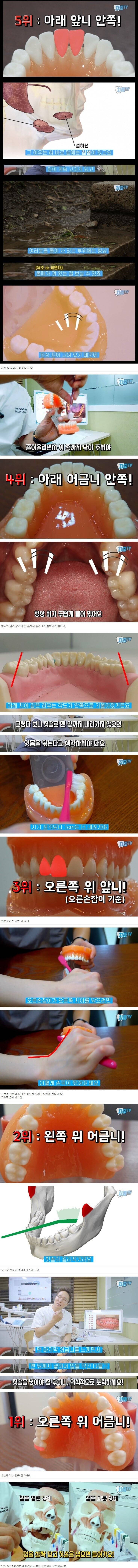 양치할 때 신경 써야하는 부위 | 인스티즈