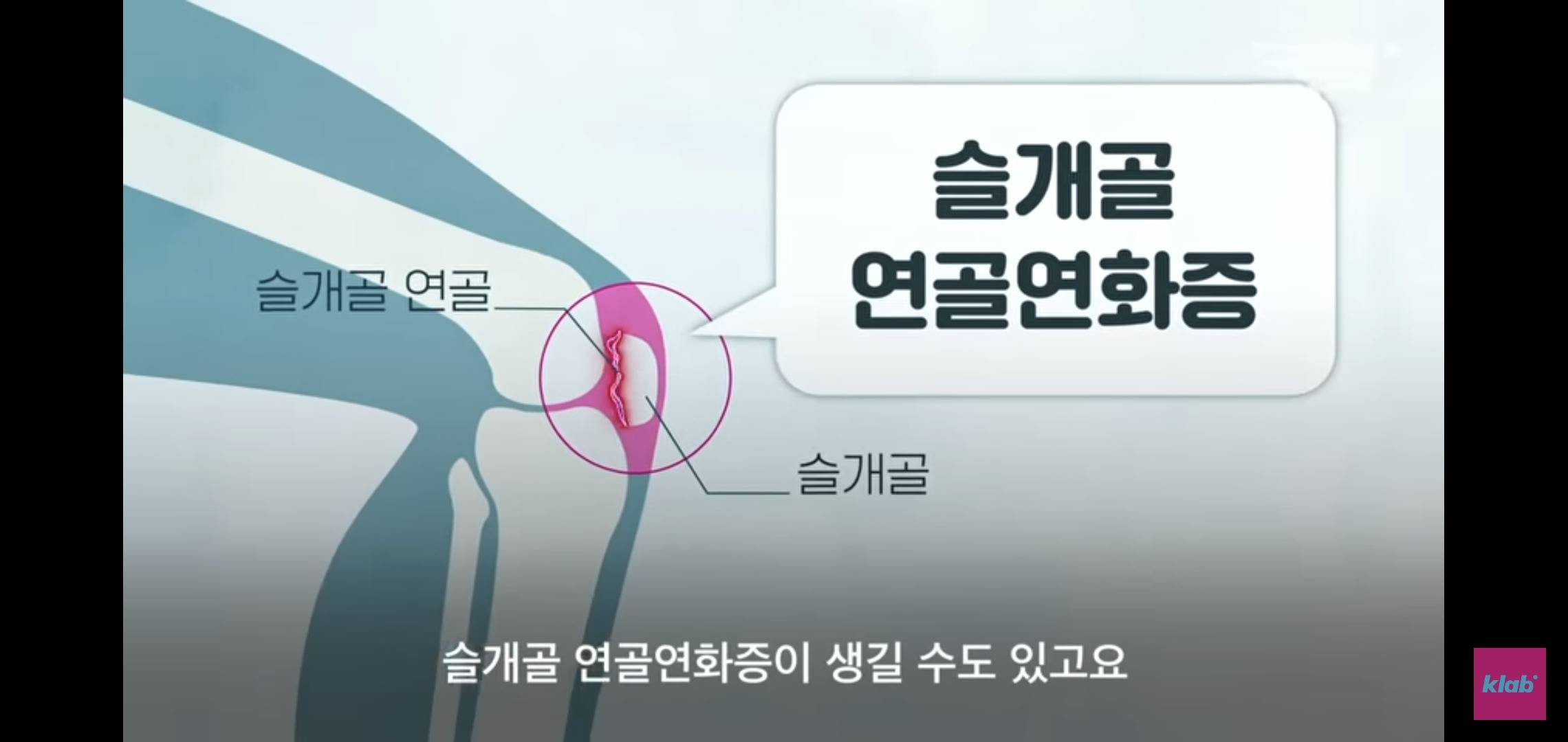 의자 위에서 양반다리가 편한 사람은 허리가 약한 것.jpg | 인스티즈