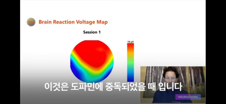 도파민 디톡스 7일이면 뇌가 변함! | 인스티즈